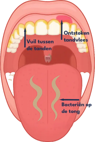 Slechte Adem Illustratie van Mint Den Bosch